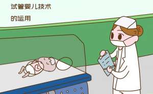 三代試管嬰兒價格如何？
