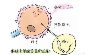 俄羅斯試管嬰兒機構(gòu)費用